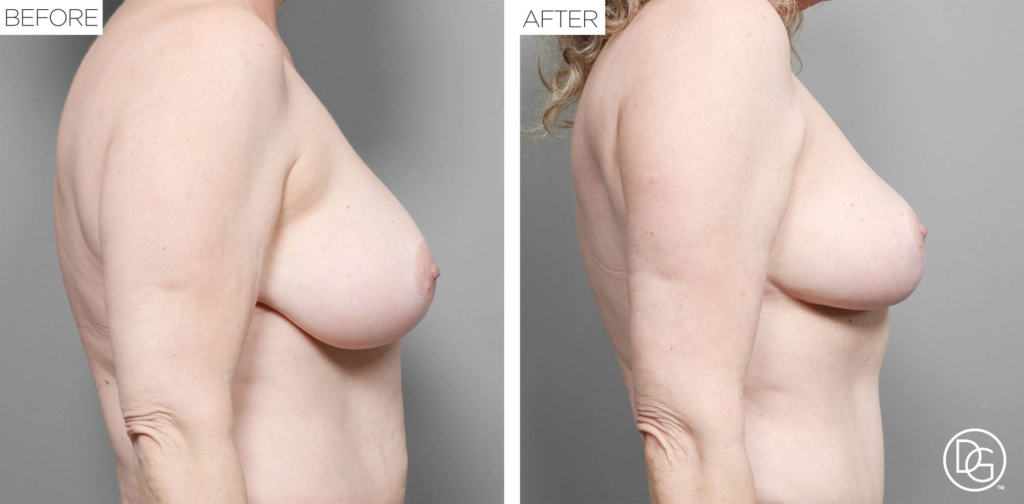 Before & After Image