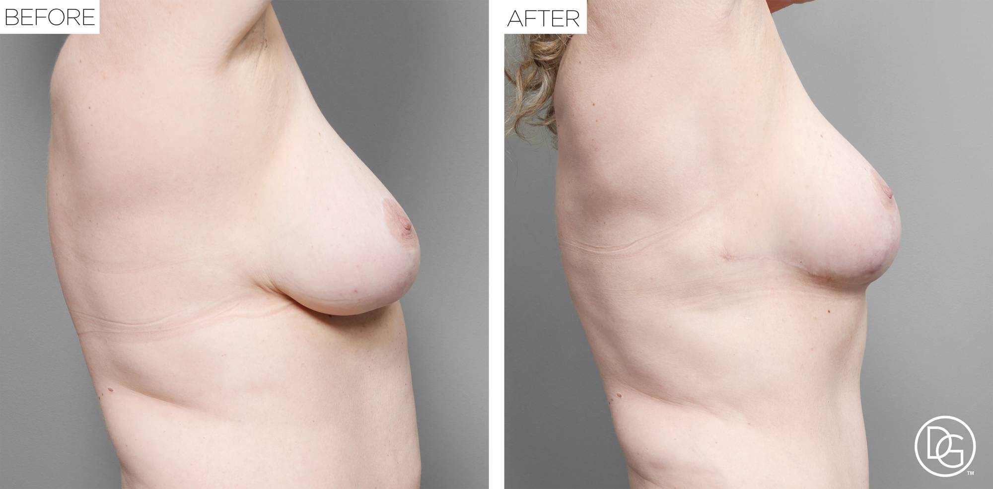 Before & After Image