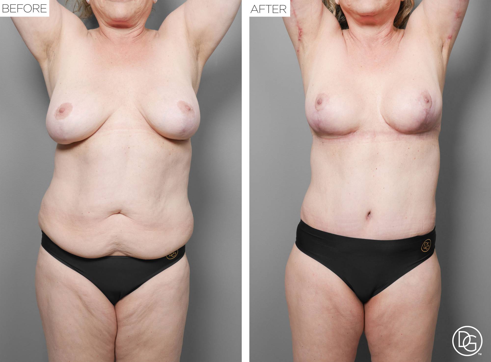 Before & After Image