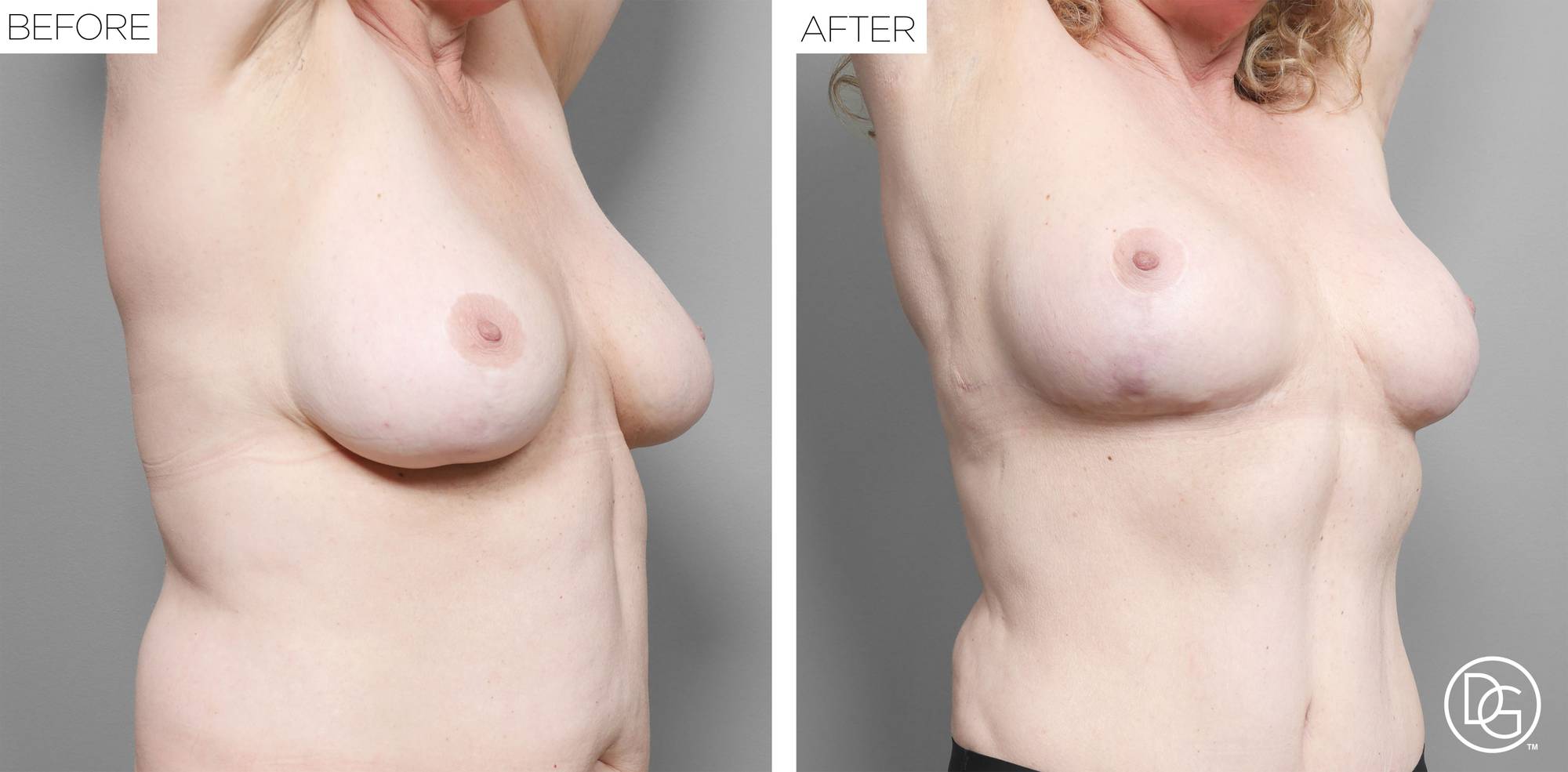 Before & After Image
