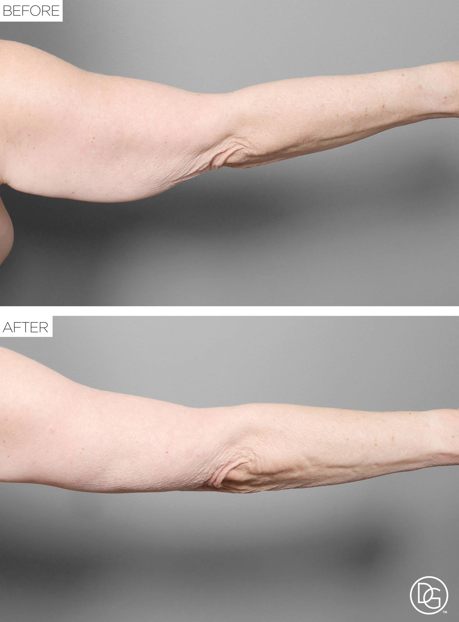 Before & After Image