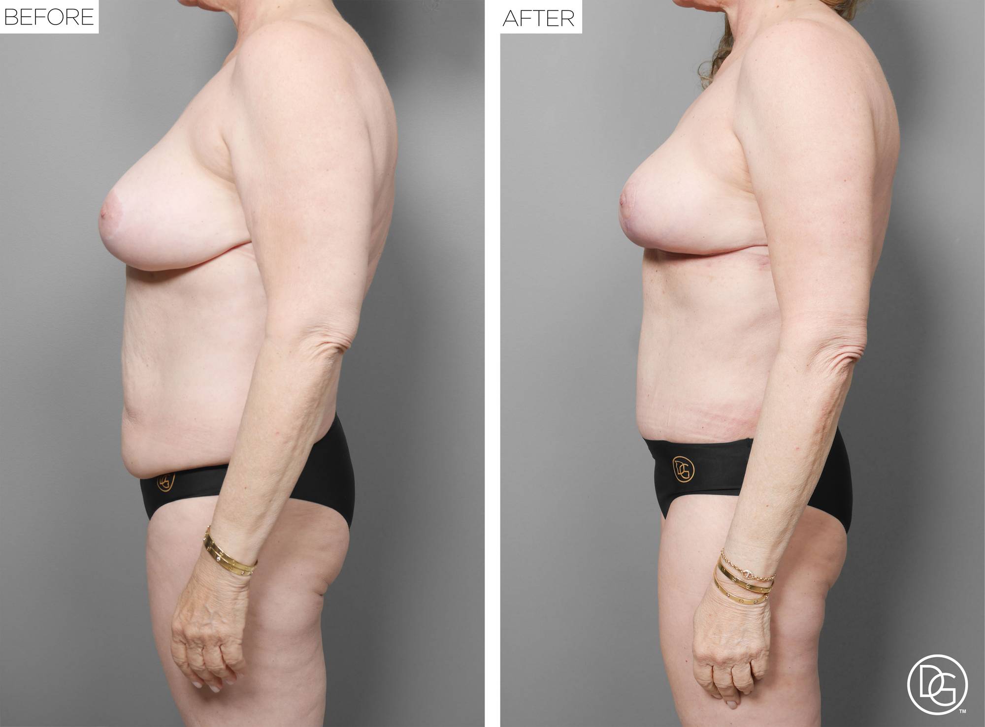 Before & After Image