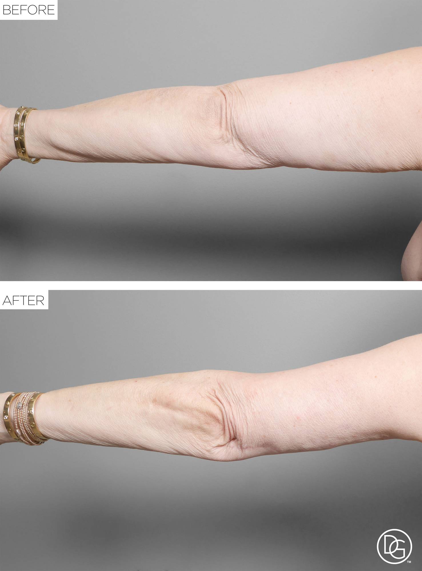 Before & After Image