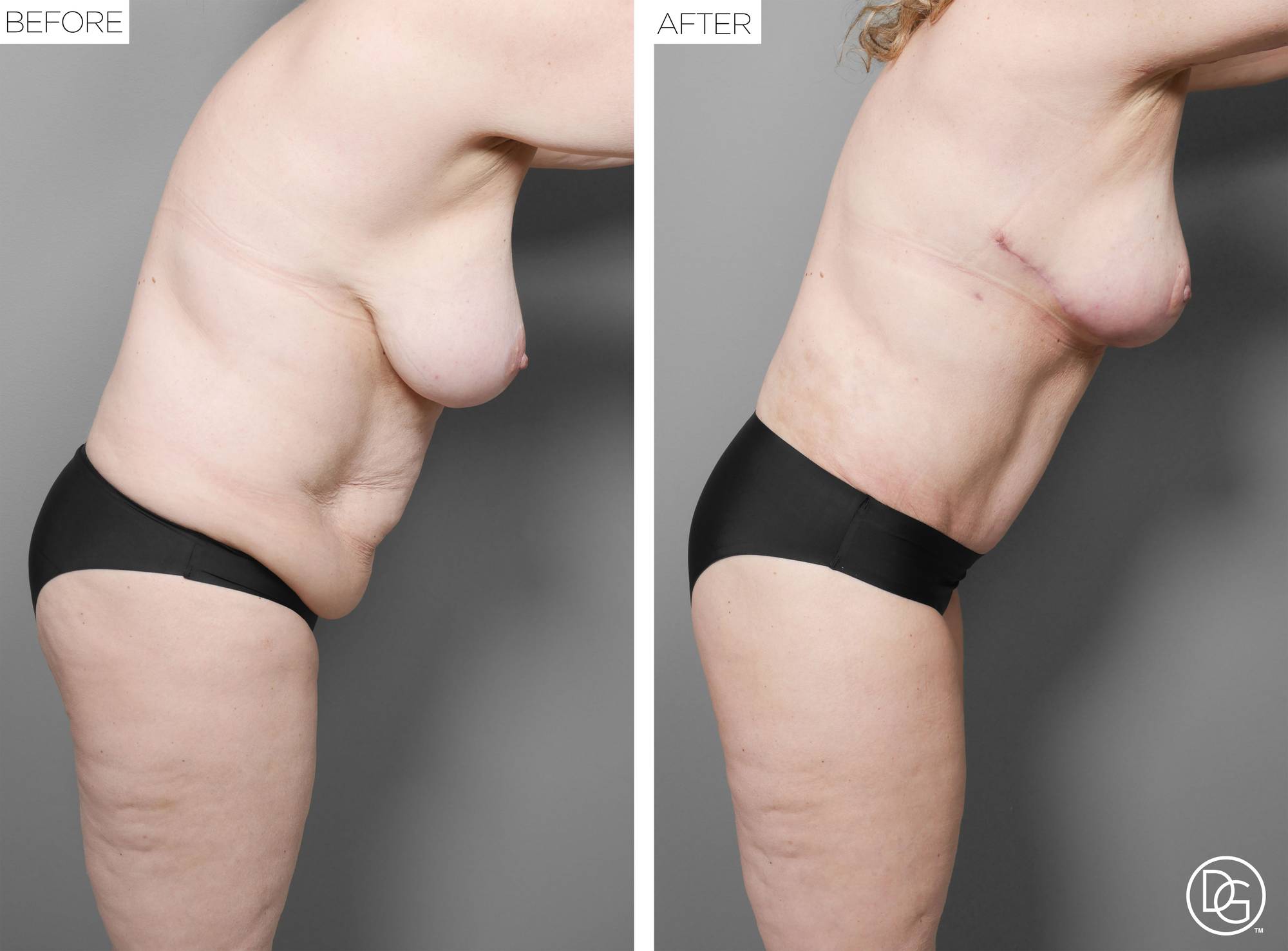 Before & After Image