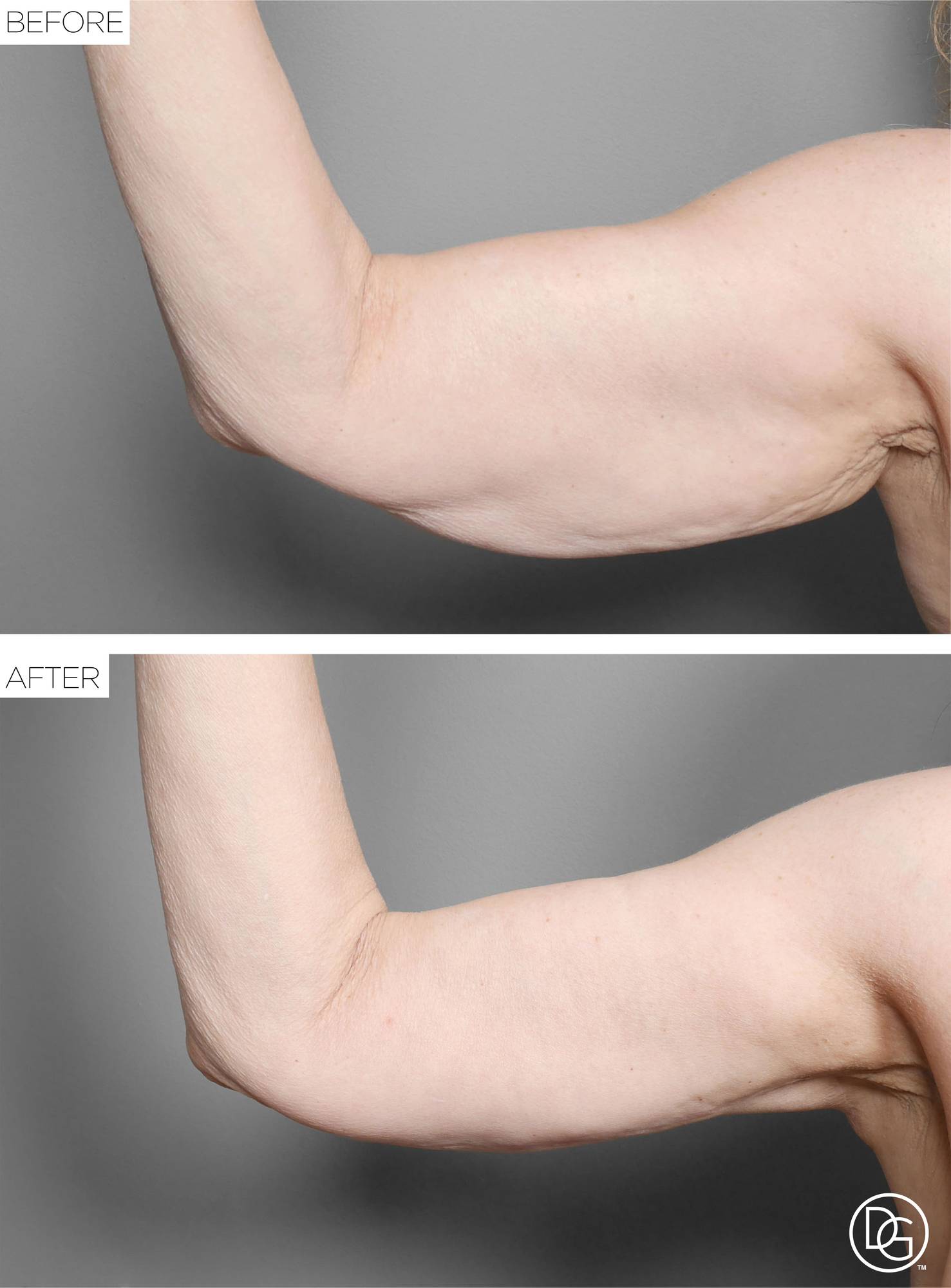 Before & After Image