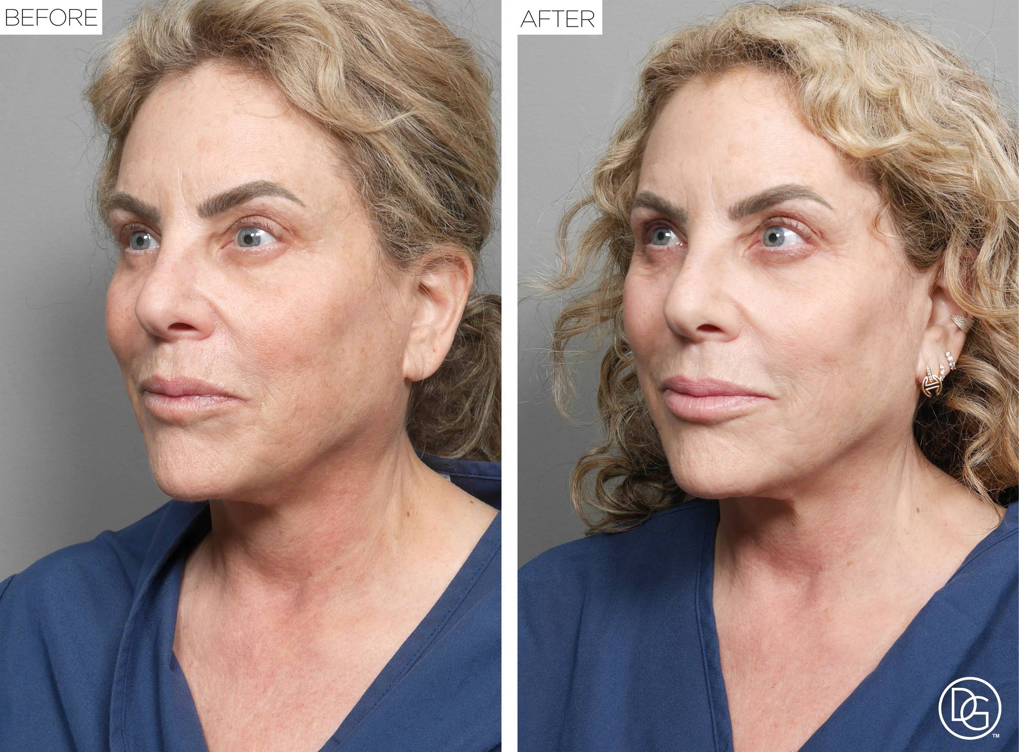 Before & After Image