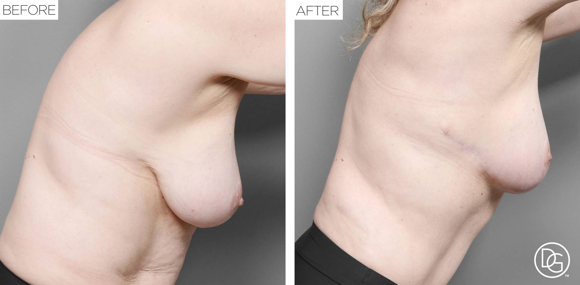 Before & After Image