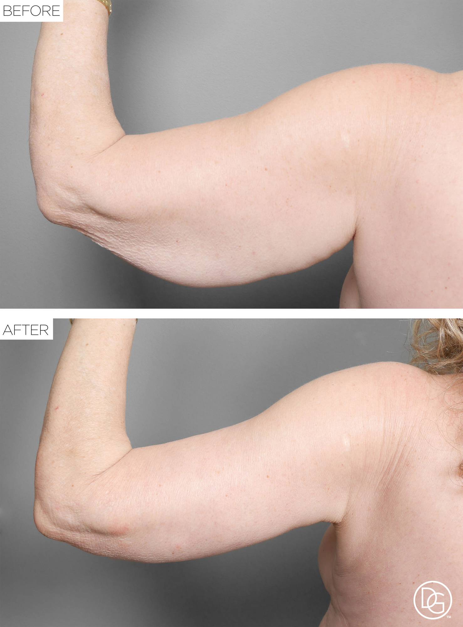 Before & After Image