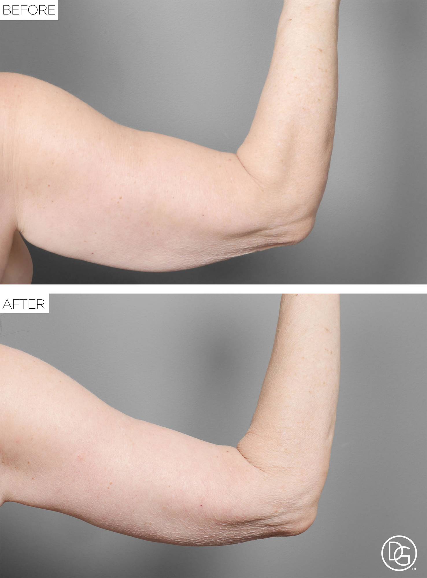 Before & After Image