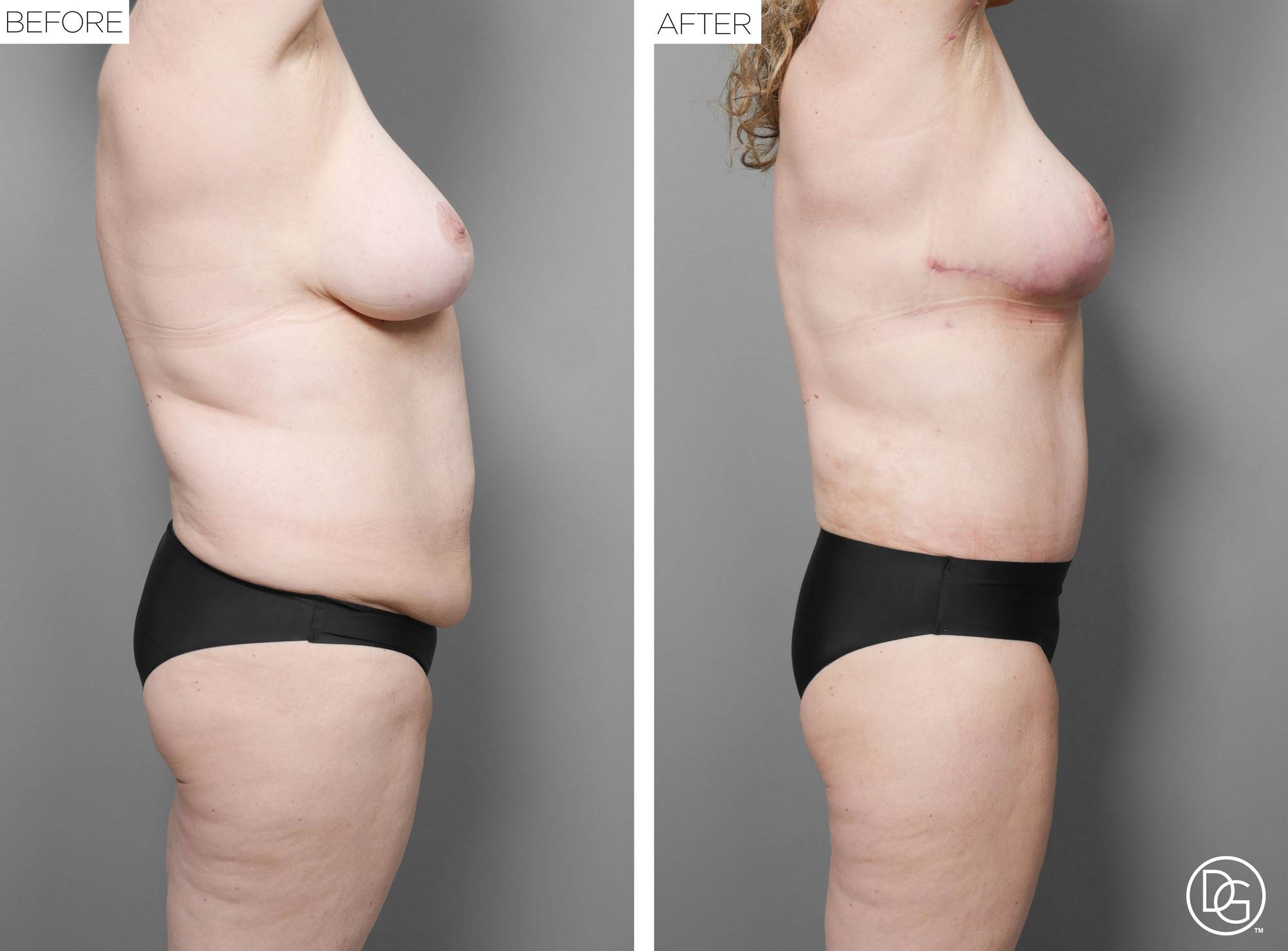 Before & After Image