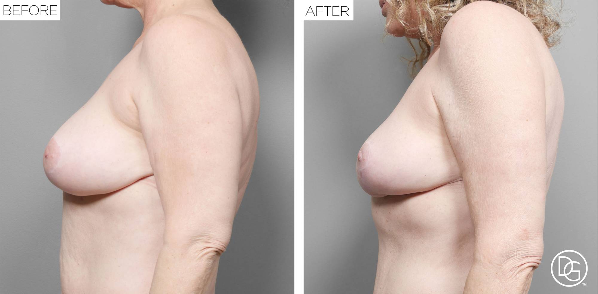 Before & After Image