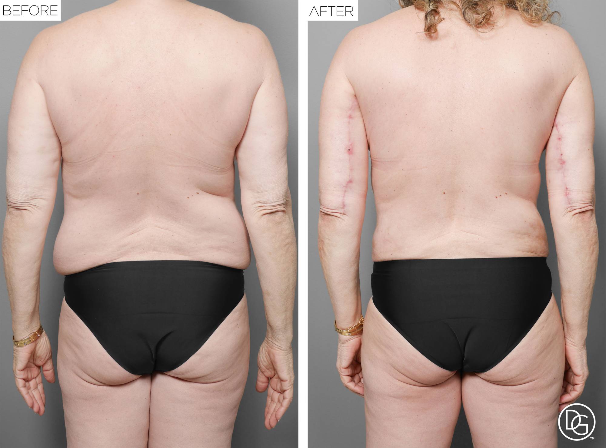 Before & After Image