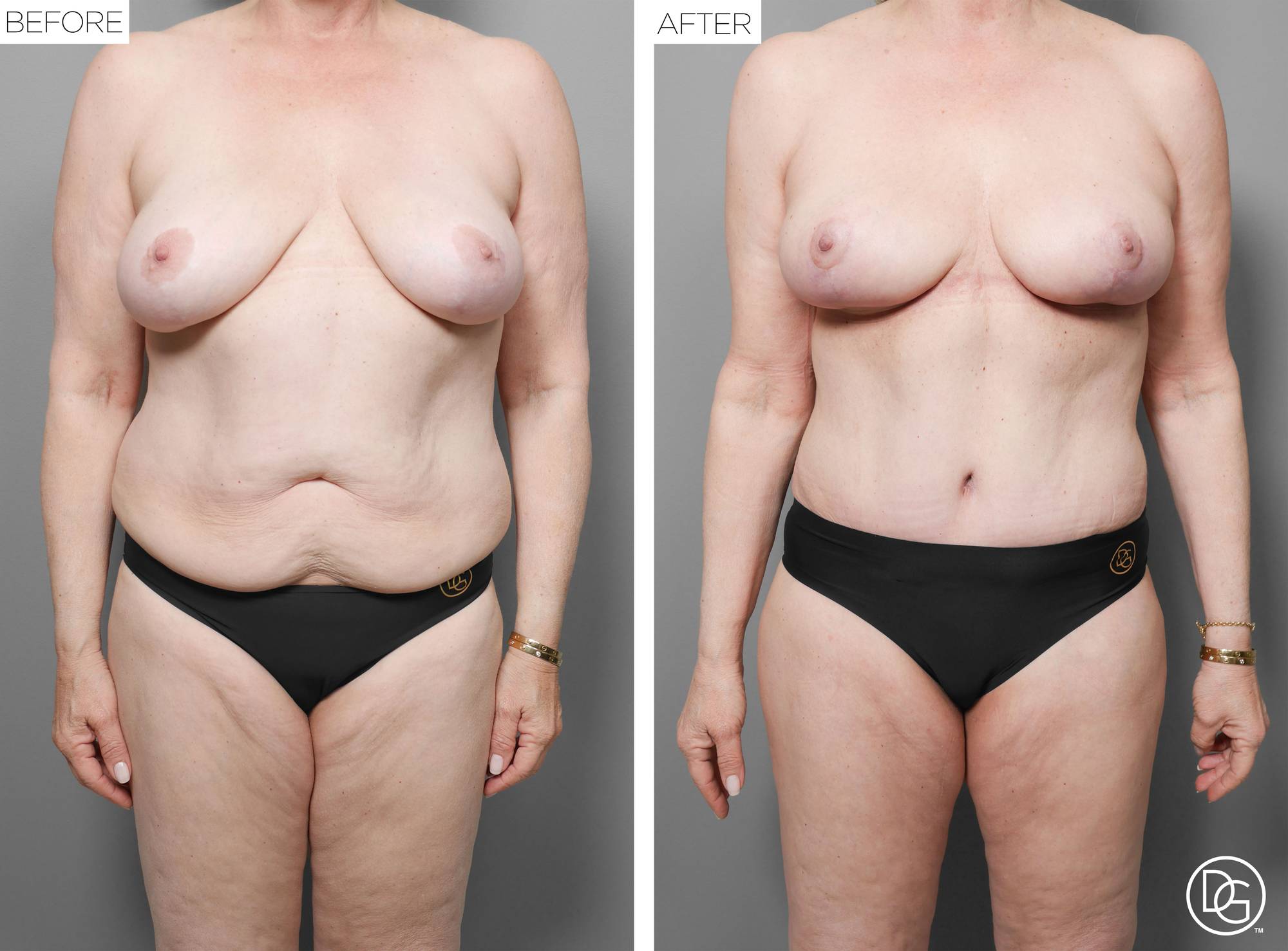 Before & After Image