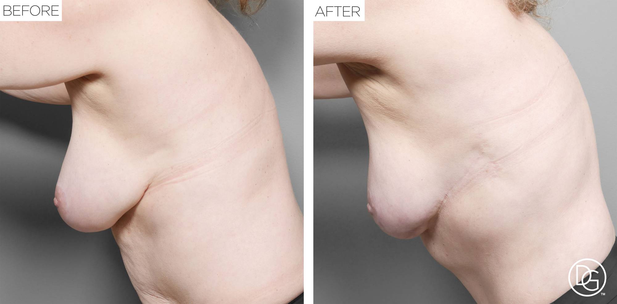 Before & After Image