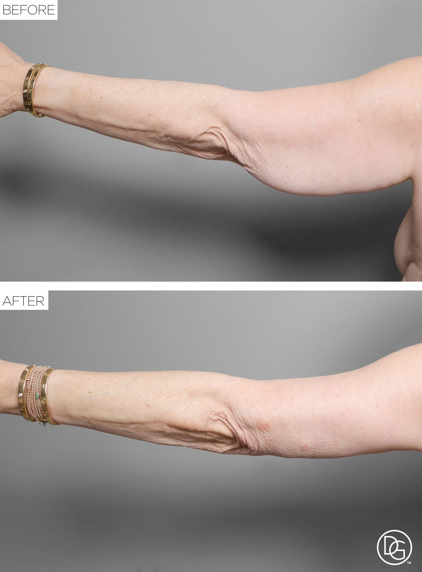 Before & After Image