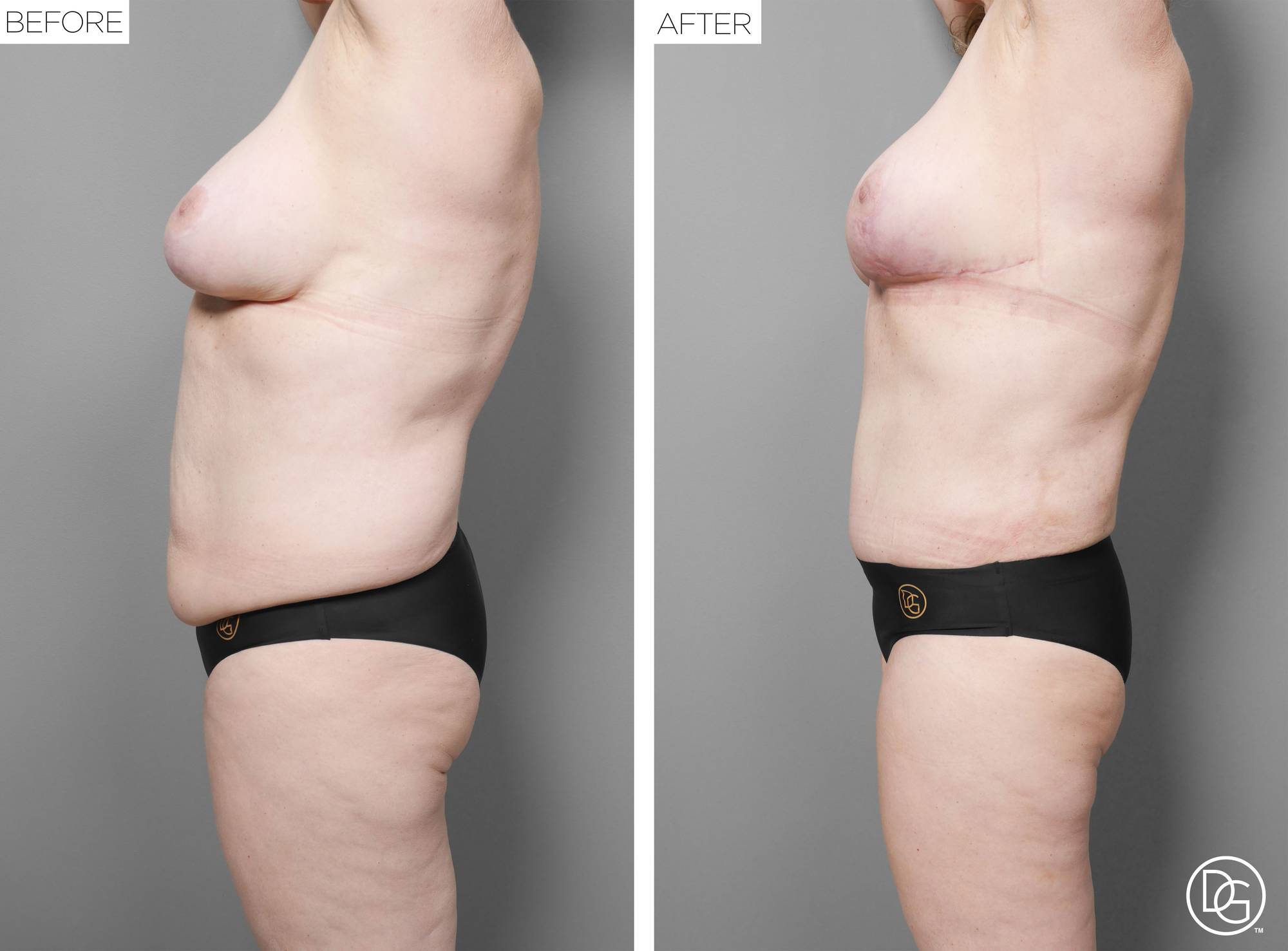 Before & After Image