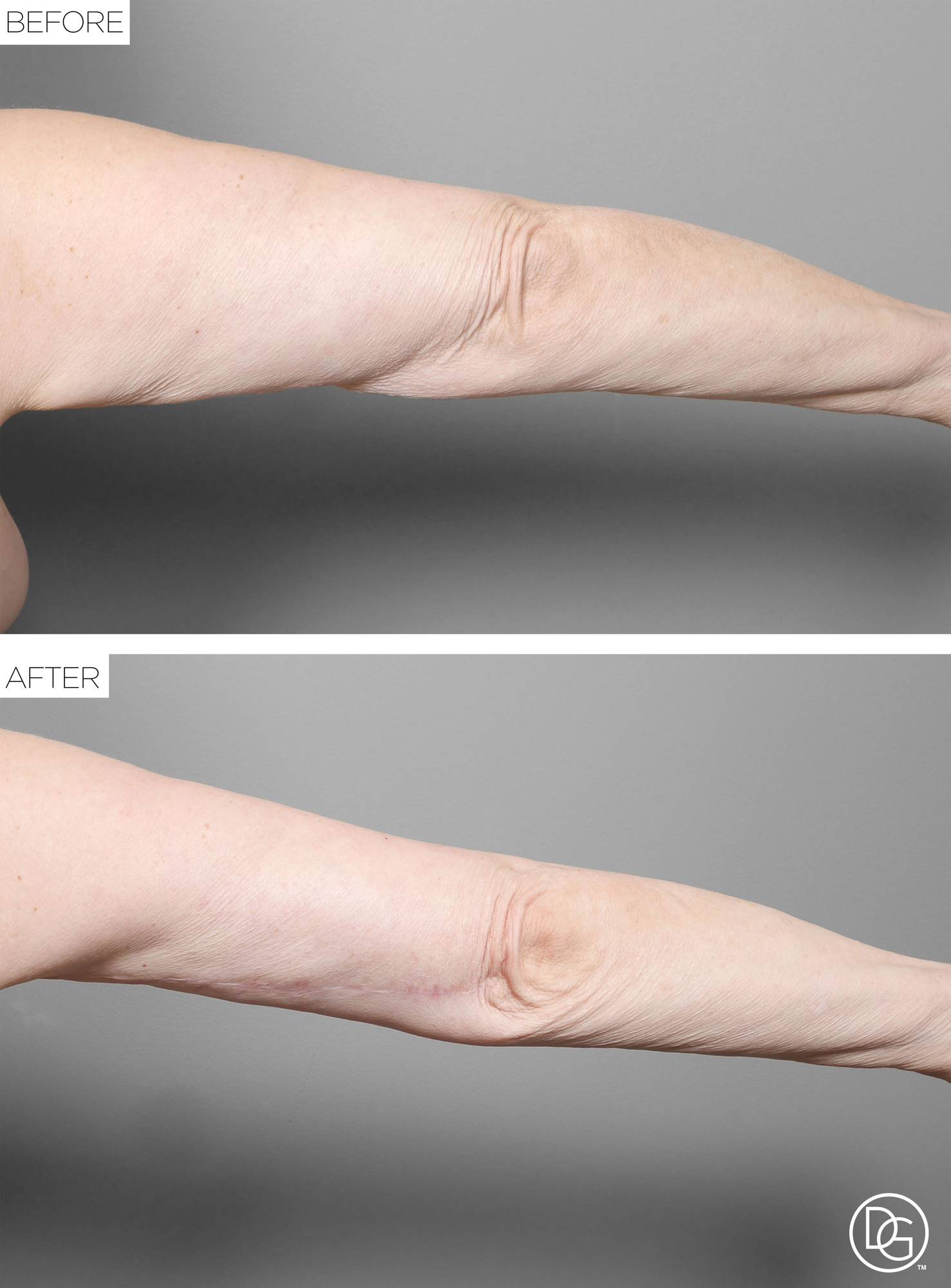 Before & After Image