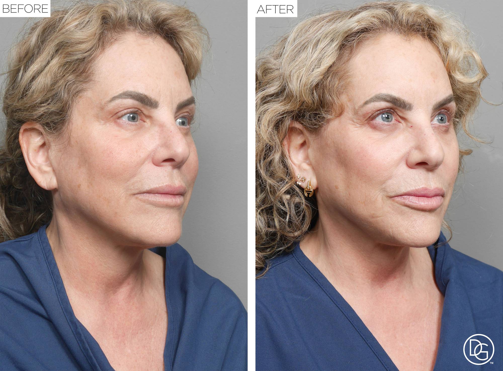 Before & After Image