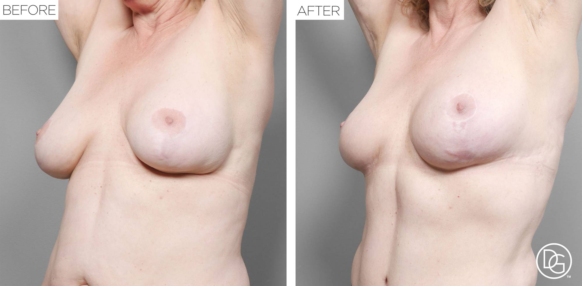 Before & After Image