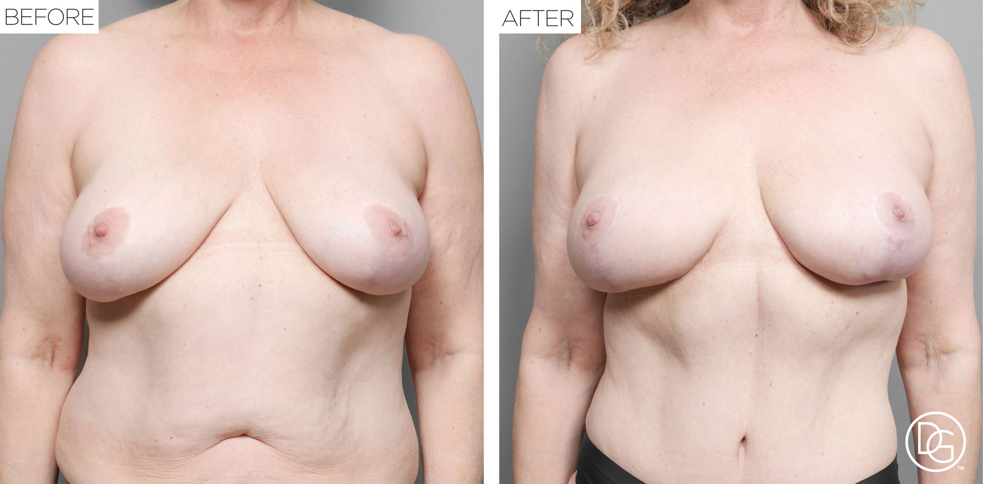 Before & After Image