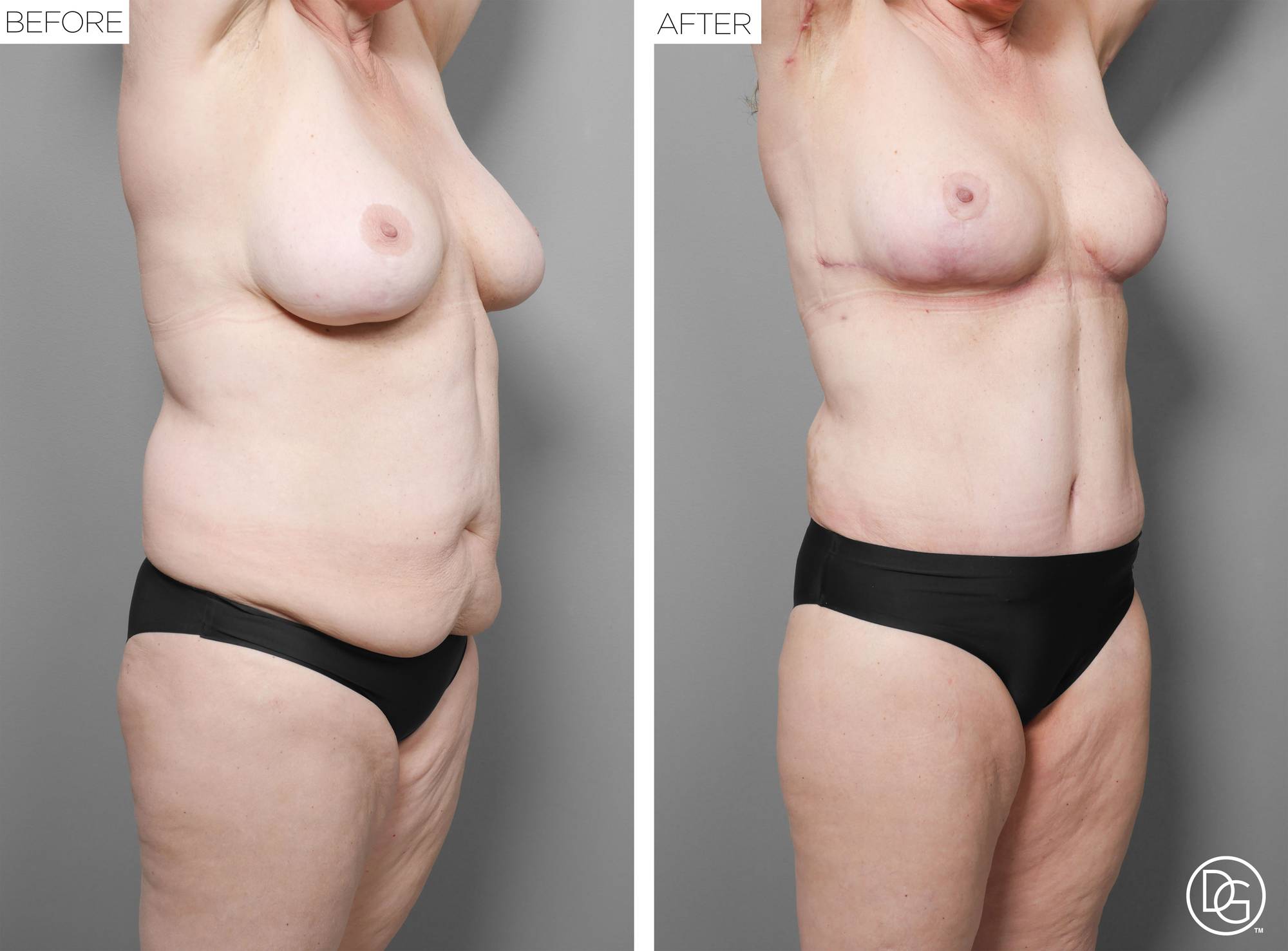 Before & After Image