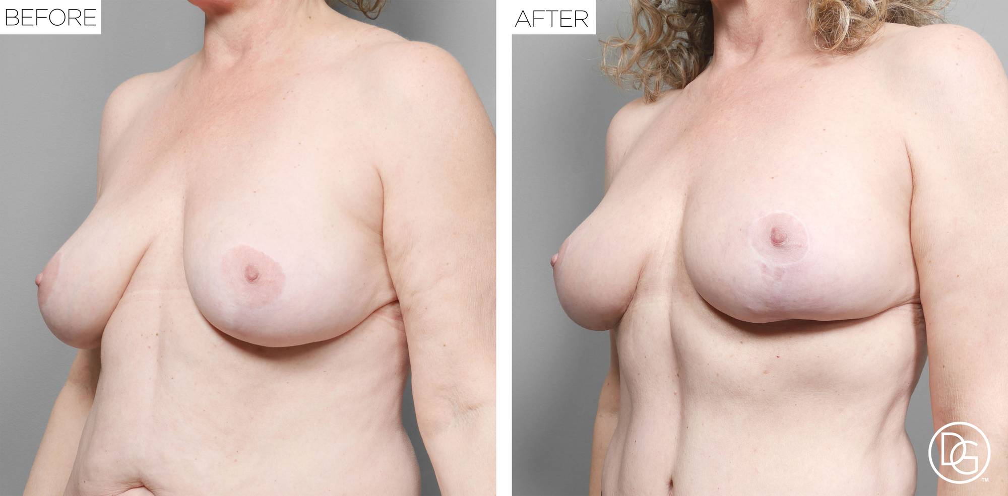 Before & After Image