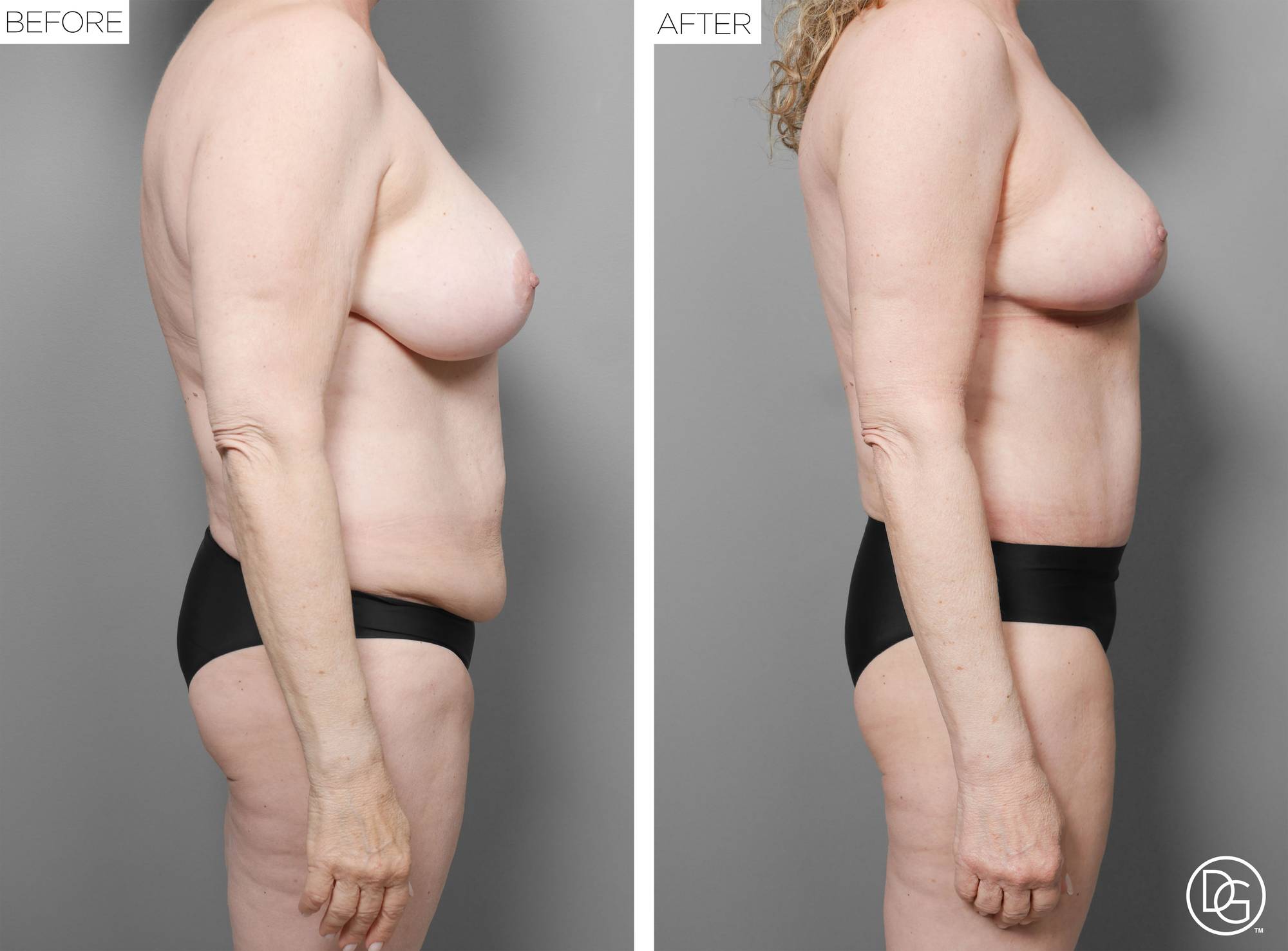 Before & After Image