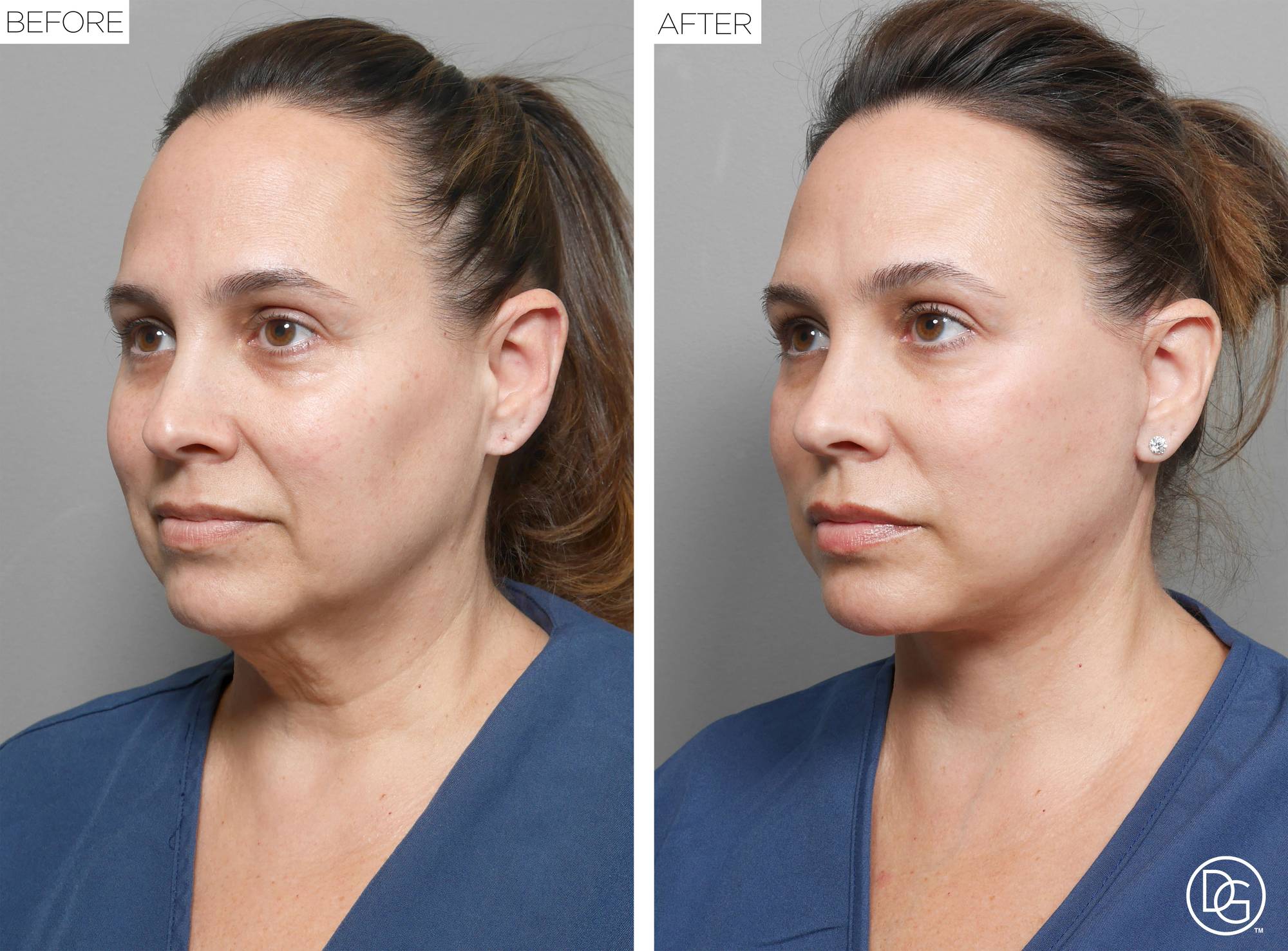 Before & After Image