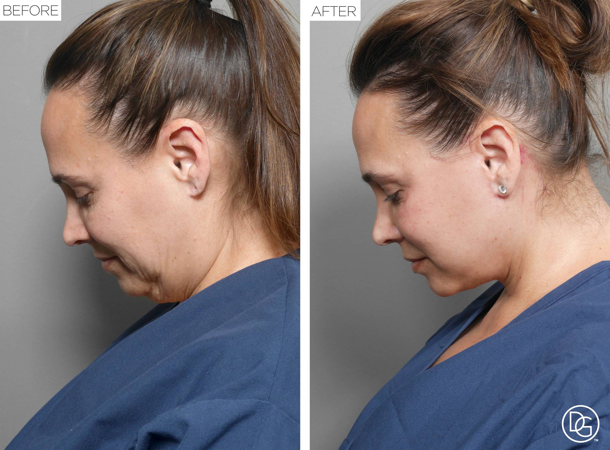 Before & After Image