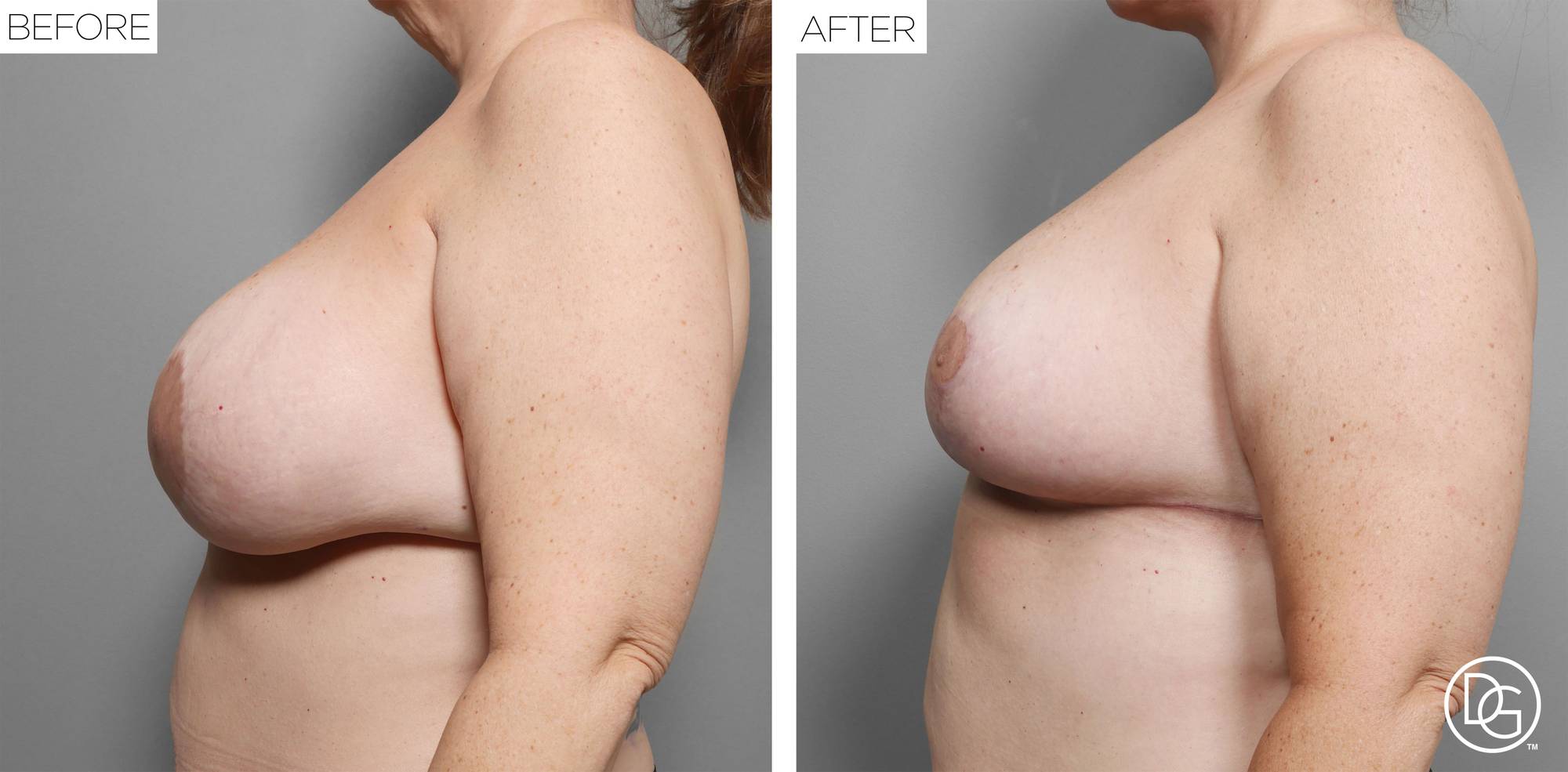Before & After Image