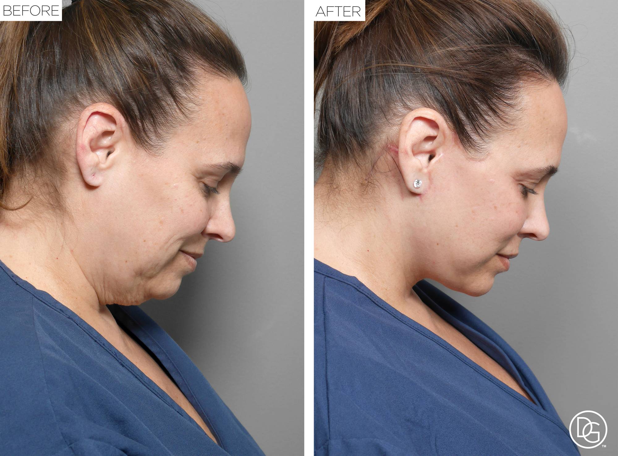 Before & After Image