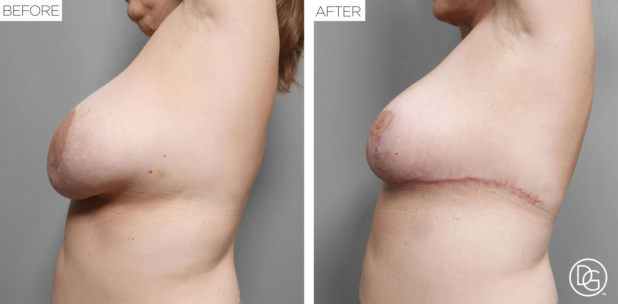 Before & After Image