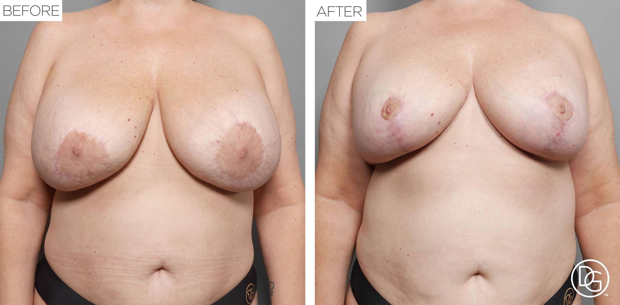 Before & After Image