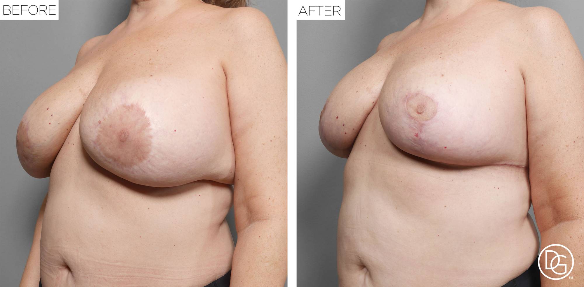 Before & After Image