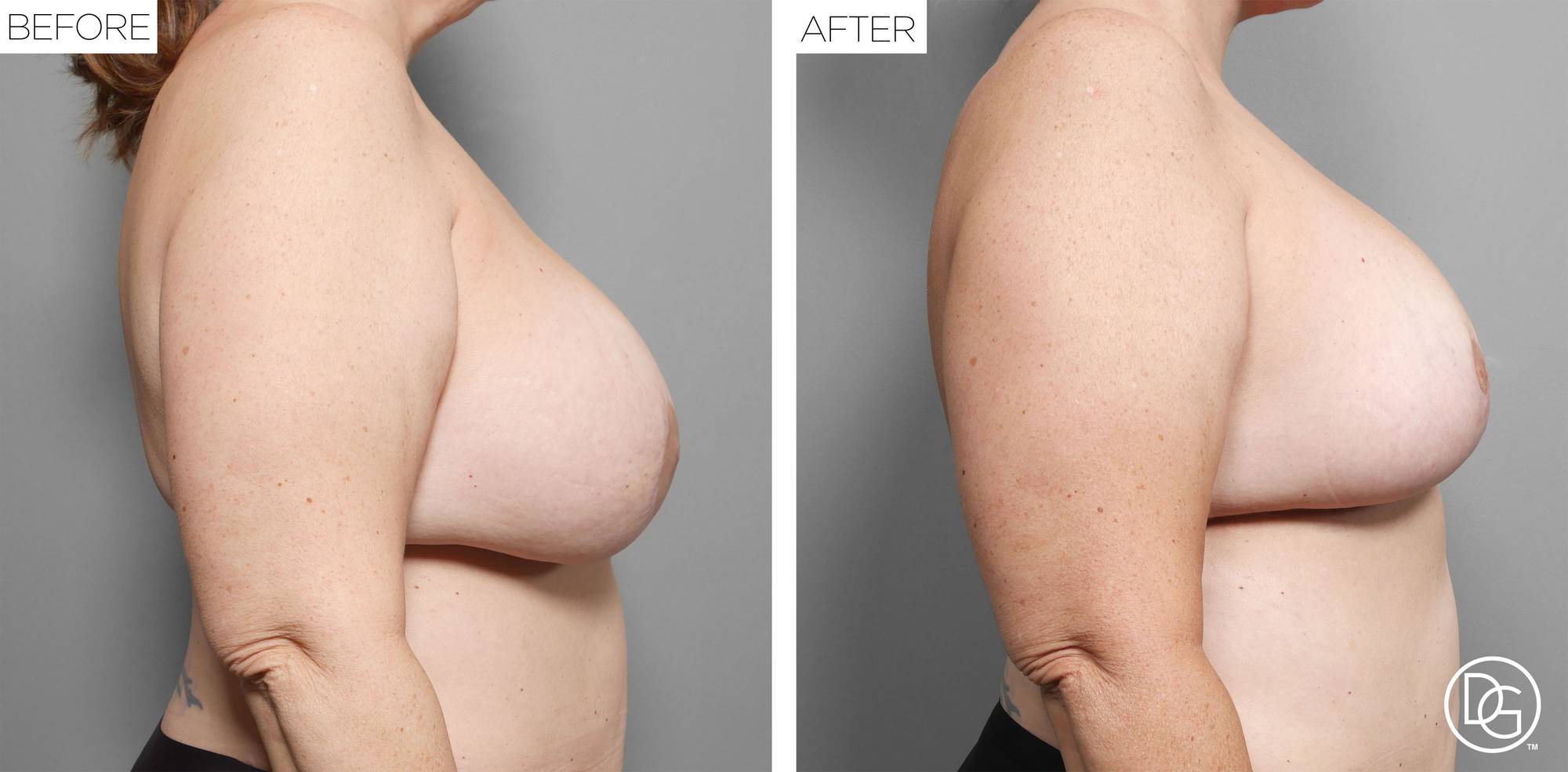 Before & After Image