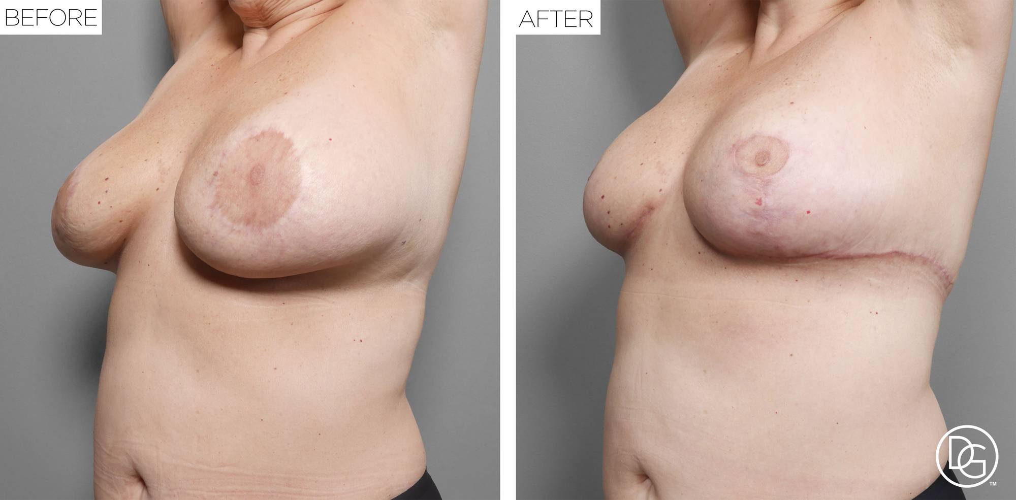 Before & After Image
