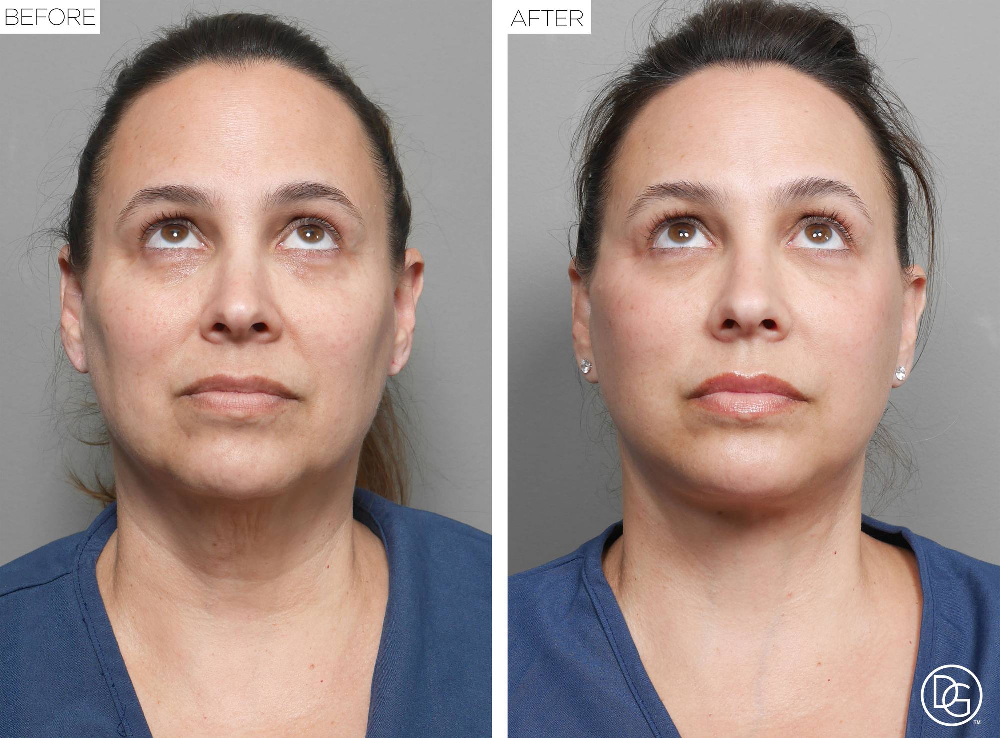 Before & After Image