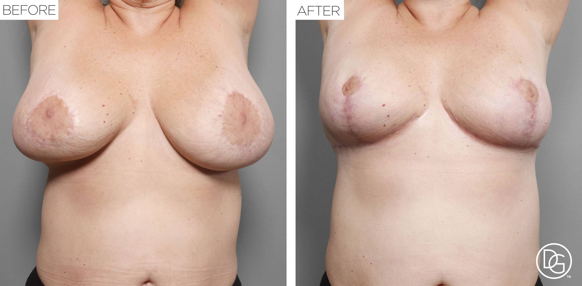 Before & After Image