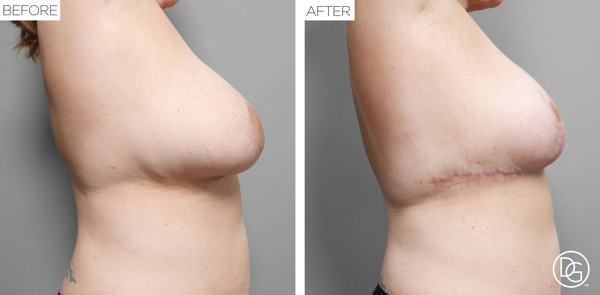 Before & After Image