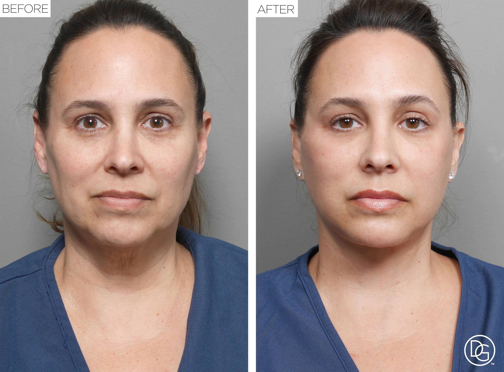 Before & After Image