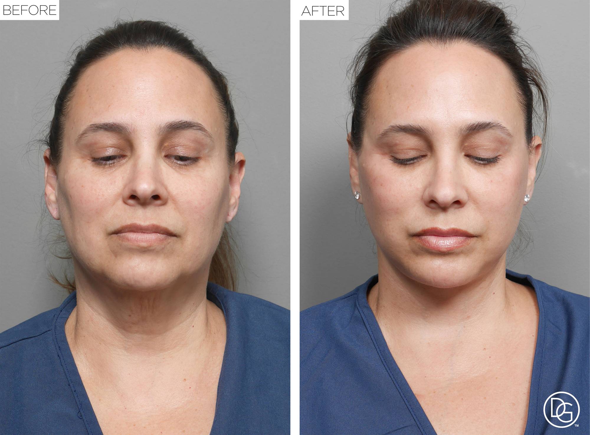 Before & After Image