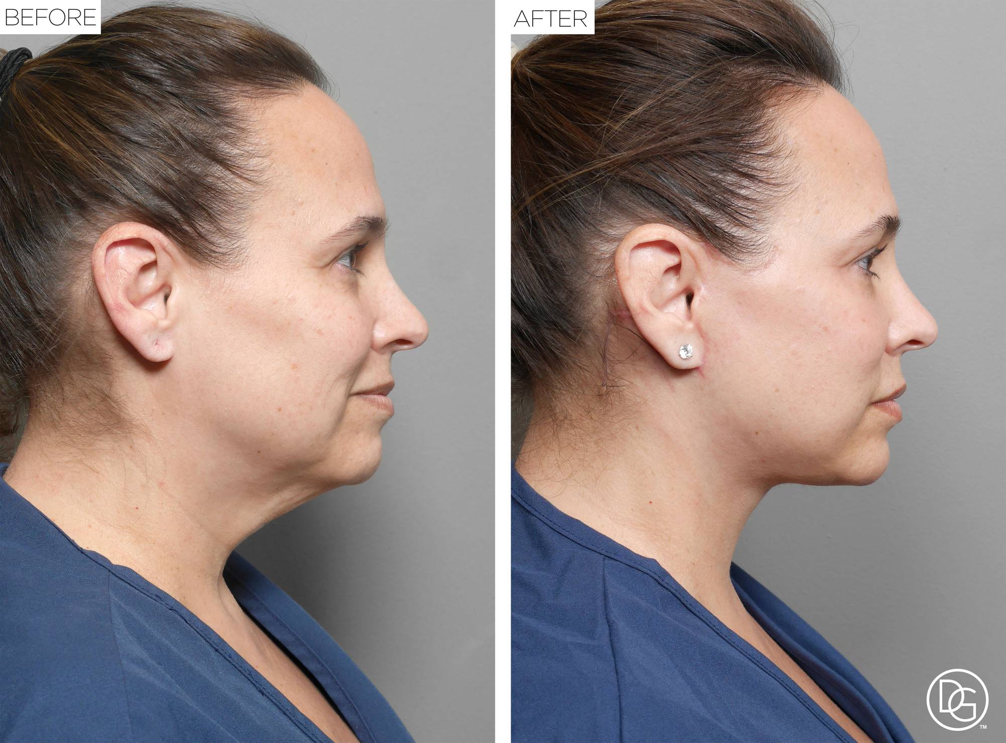 Before & After Image