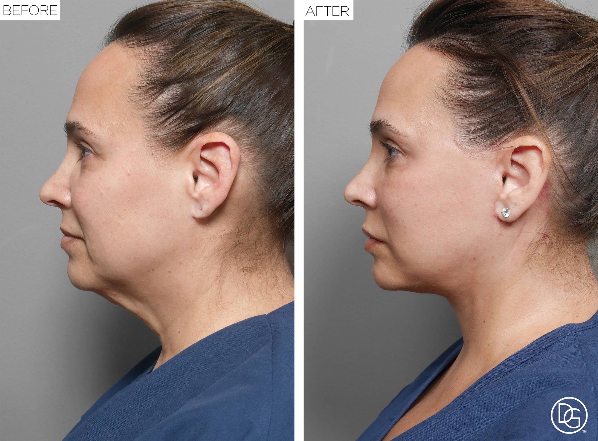 Before & After Image