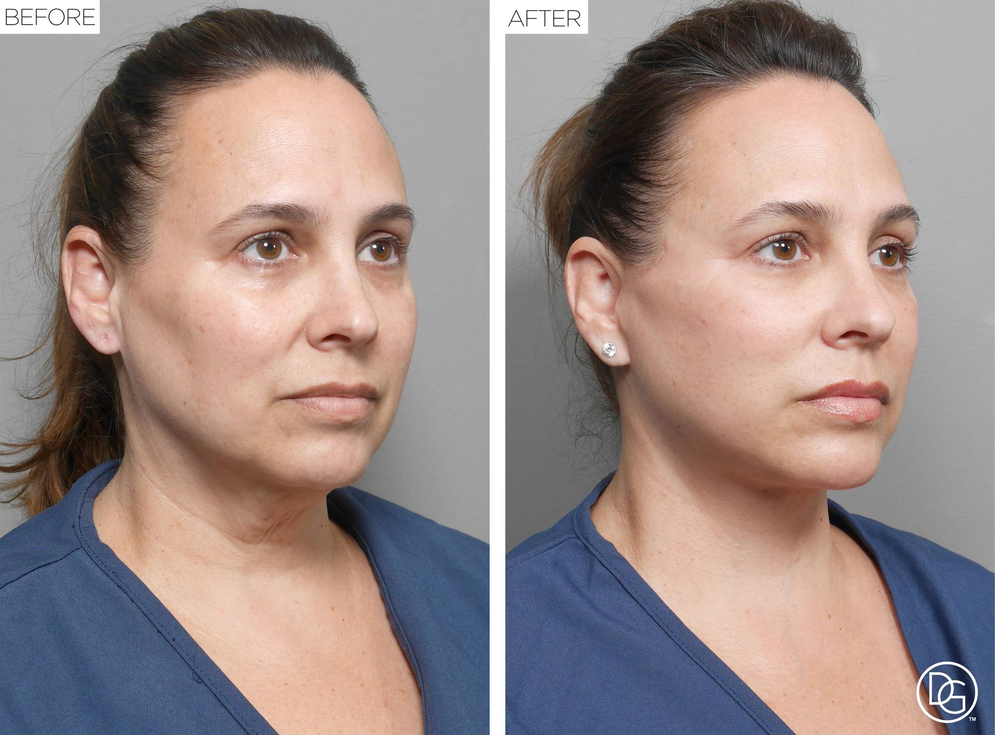 Before & After Image