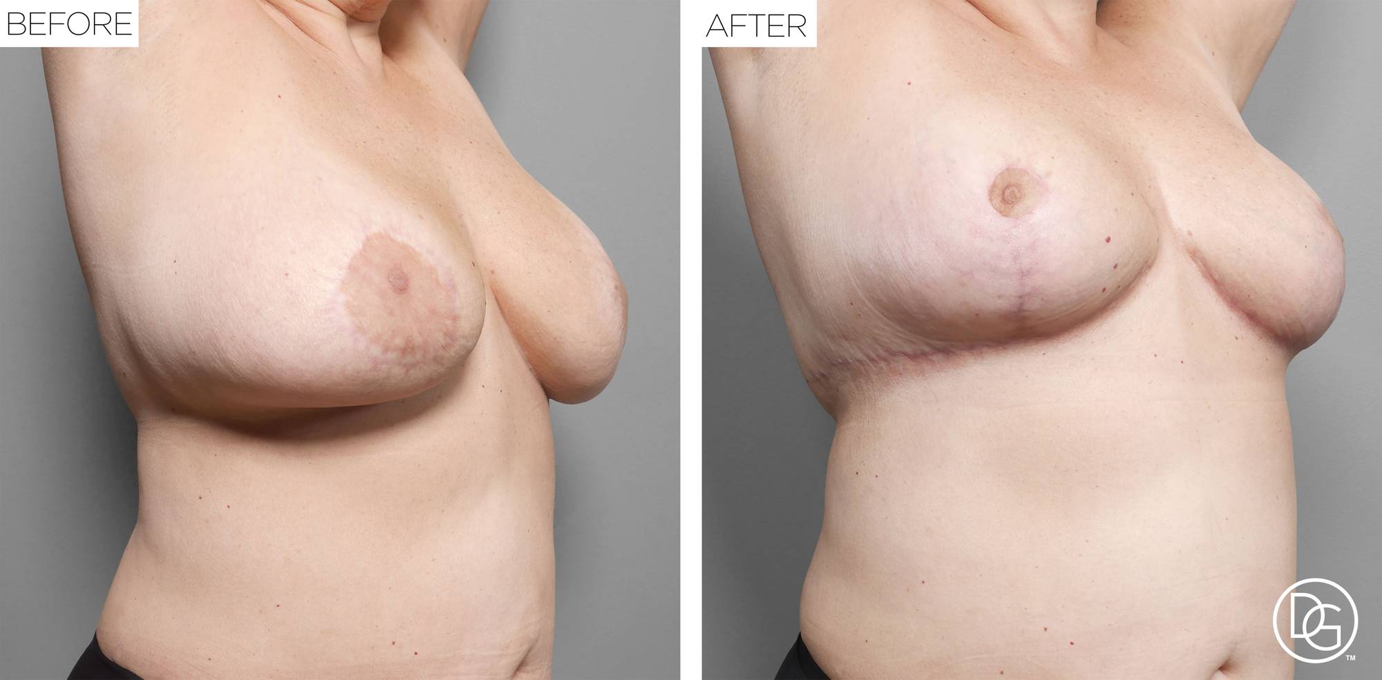 Before & After Image