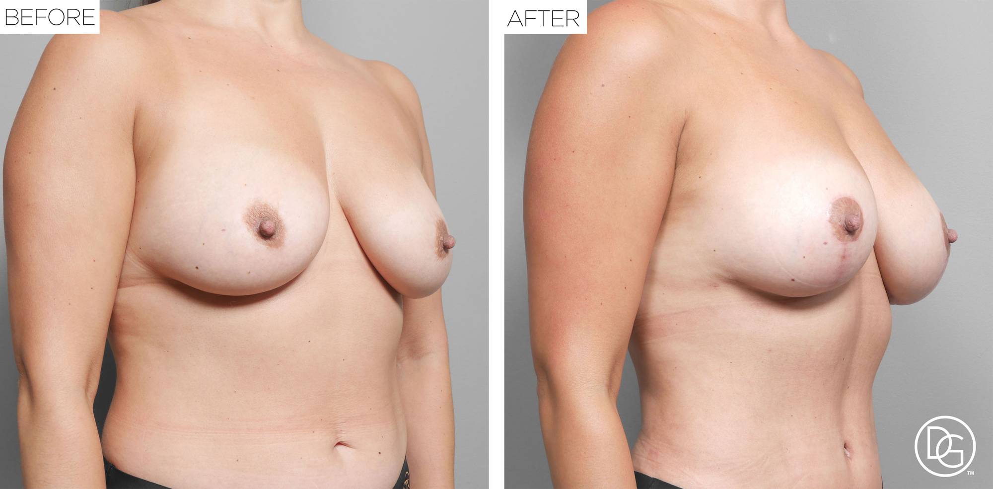 Before & After Image