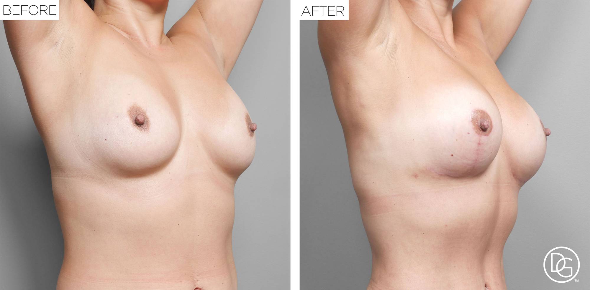 Before & After Image