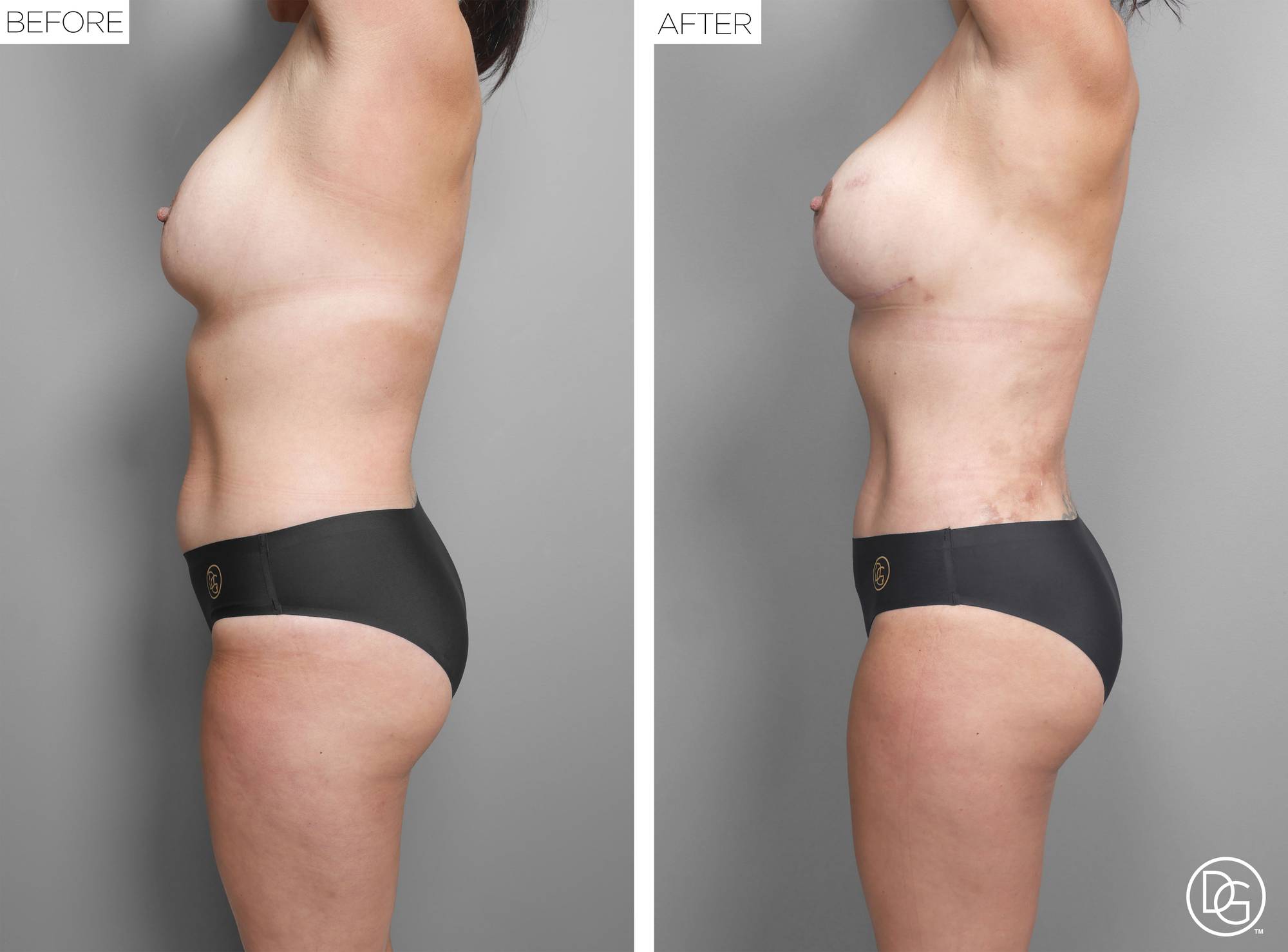 Before & After Image