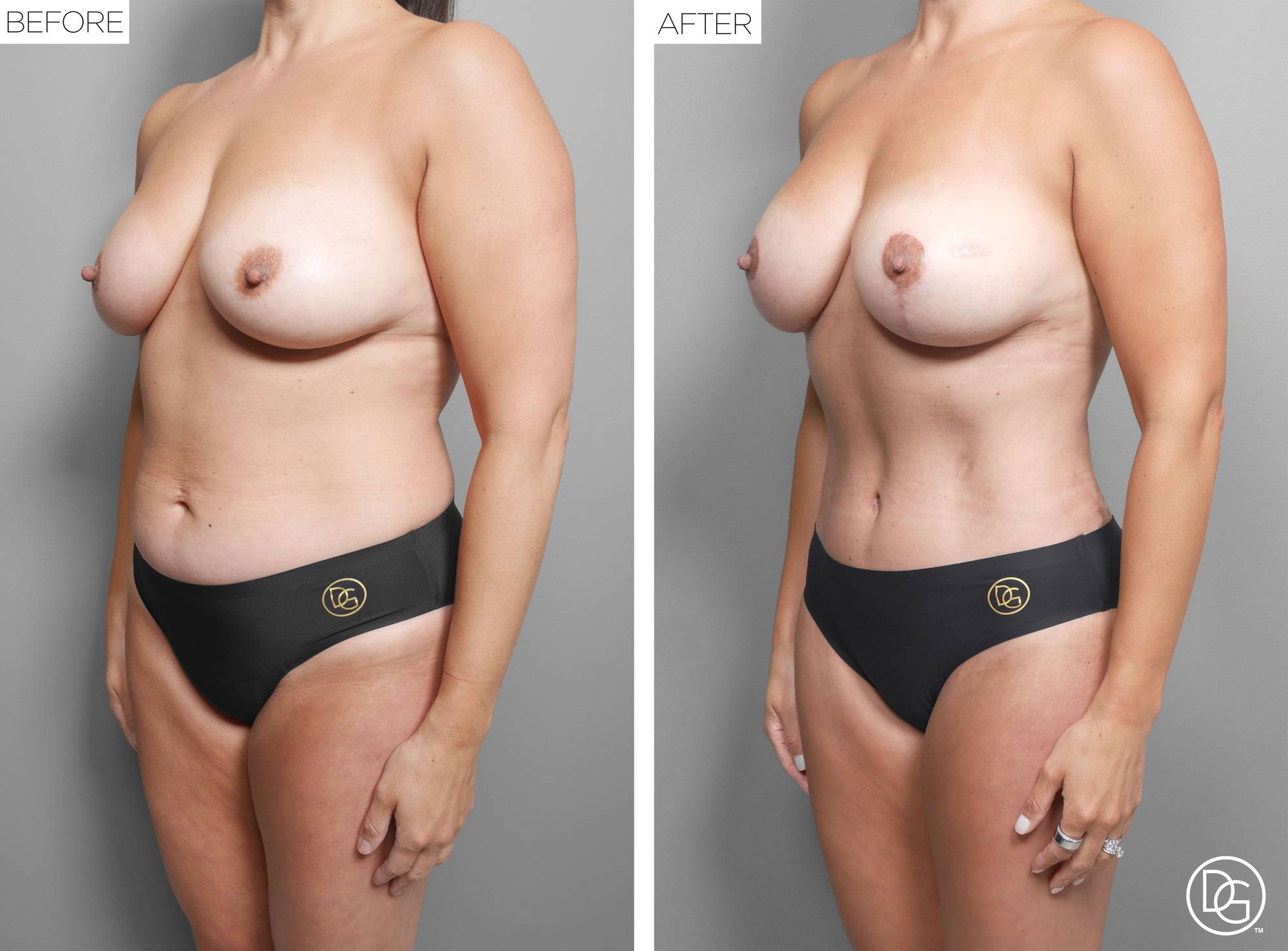 Before & After Image