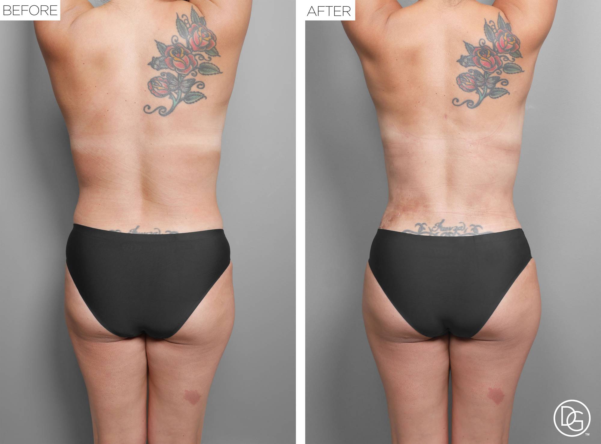 Before & After Image